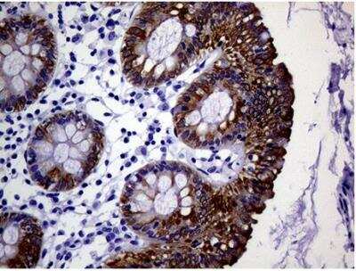 Immunohistochemistry-Paraffin: Cytokeratin 18 Antibody (OTI1E1) [NBP1-47817]