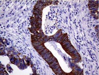 Immunohistochemistry-Paraffin: Cytokeratin 18 Antibody (OTI1E1) [NBP1-47817]