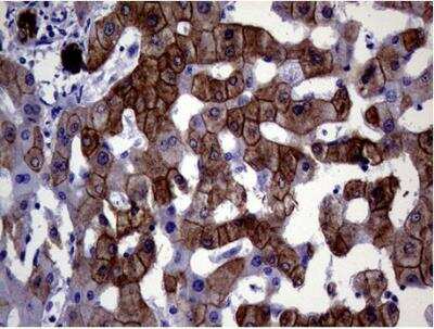Immunohistochemistry-Paraffin: Cytokeratin 18 Antibody (OTI1E1) [NBP1-47817]