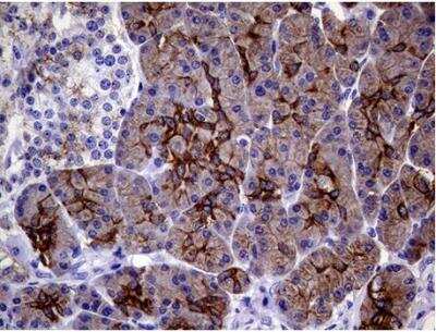 Immunohistochemistry-Paraffin: Cytokeratin 18 Antibody (OTI1E1) [NBP1-47817]