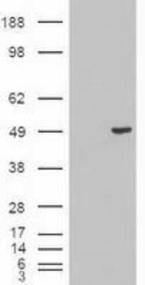 Western Blot: Cytokeratin 18 Antibody (OTI1E1) [NBP1-47817]