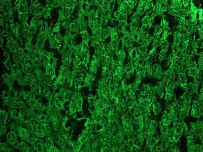 Immunohistochemistry-Frozen: Cytokeratin 18 Antibody (RGE53) - BSA Free [NBP1-97715]