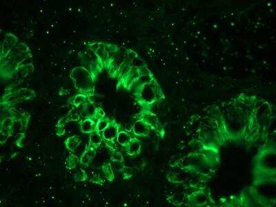 Immunohistochemistry: Cytokeratin 18 Antibody (RGE53) - BSA Free [NBP1-97715]