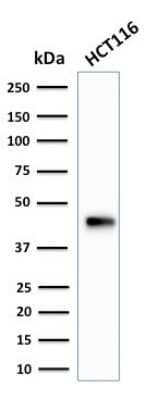 Western Blot: Cytokeratin 18 Antibody (SPM265) [NBP2-34356]