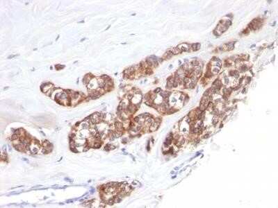 Immunohistochemistry-Paraffin: Cytokeratin 18 Antibody (SPM510) - Azide and BSA Free [NBP2-34414]