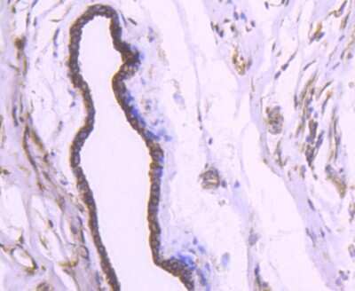 Immunohistochemistry-Paraffin: Cytokeratin 18 Antibody (SZ80-07) [NBP2-67370]