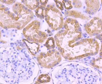 Immunohistochemistry-Paraffin: Cytokeratin 18 Antibody (SZ80-07) [NBP2-67370]