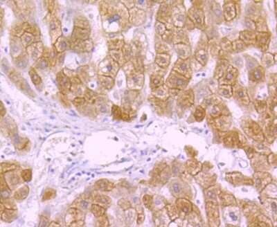 Immunohistochemistry-Paraffin: Cytokeratin 18 Antibody (SZ80-07) [NBP2-67370]