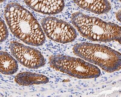Immunohistochemistry-Paraffin: Cytokeratin 18 Antibody (SZ80-07) [NBP2-67370]