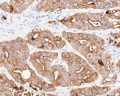 Immunohistochemistry-Paraffin: Cytokeratin 18 Antibody (SZ80-07) [NBP2-67370]