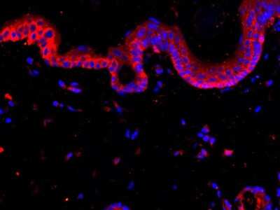 Immunohistochemistry-Paraffin: Cytokeratin 18 Antibody (SZ80-07) [NBP2-67370]