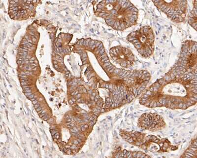 Immunohistochemistry-Paraffin: Cytokeratin 18 Antibody (SZ80-07) [NBP2-67370]