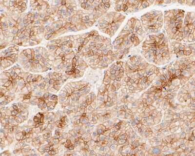 Immunohistochemistry-Paraffin: Cytokeratin 18 Antibody (SZ80-07) [NBP2-67370]
