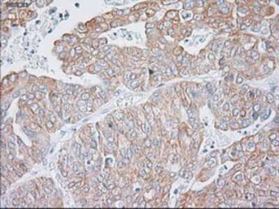 Immunohistochemistry-Paraffin: Cytokeratin 19 Antibody (OTI3F8) [NBP1-48277]