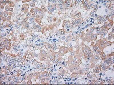 Immunohistochemistry-Paraffin: Cytokeratin 19 Antibody (OTI3F8) [NBP1-48277]