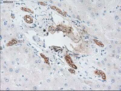 Immunohistochemistry-Paraffin: Cytokeratin 19 Antibody (OTI3F8) [NBP1-48277]