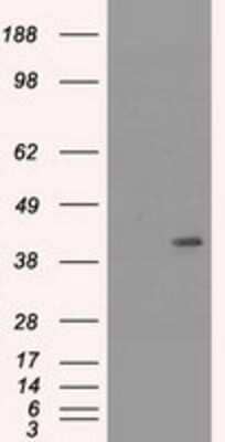 Western Blot: Cytokeratin 19 Antibody (OTI3F8) [NBP1-48277]