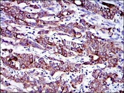 Immunohistochemistry: Cytokeratin 19 Antibody (4E8) - Azide and BSA Free [NBP2-80689]