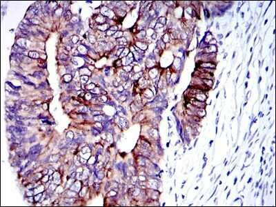 Immunohistochemistry: Cytokeratin 19 Antibody (4E8) - Azide and BSA Free [NBP2-80689]