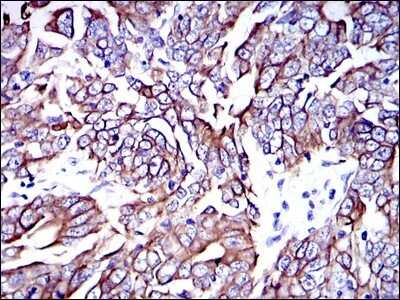 Immunohistochemistry: Cytokeratin 19 Antibody (4E8) - Azide and BSA Free [NBP2-80689]