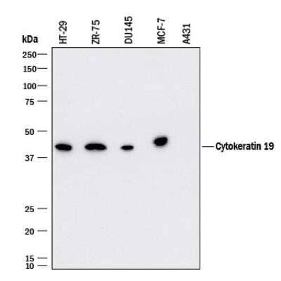 Western Blot: Cytokeratin 19 Antibody (963410) [MAB35062]