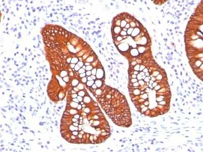 Immunohistochemistry-Paraffin: Cytokeratin 19 Antibody (A53-B/A2.26 + BA17) - Azide and BSA Free [NBP2-34548]