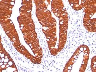 Immunohistochemistry-Paraffin: Cytokeratin 19 Antibody (A53-B/A2.26) - Azide and BSA Free [NBP2-33134]