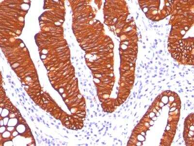 Immunohistochemistry-Paraffin: Cytokeratin 19 Antibody (A53-B/A2.26) [NBP2-15186]