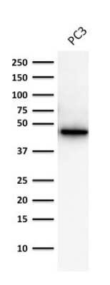 Western Blot: Cytokeratin 19 Antibody (A53-B/A2.26) [NBP2-15186]