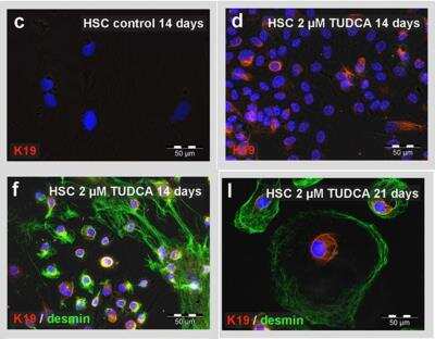 Immunocytochemistry/ Immunofluorescence: Cytokeratin 19 Antibody - BSA Free [NB100-687]