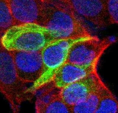 Immunocytochemistry/ Immunofluorescence: Cytokeratin 19 Antibody - BSA Free [NBP1-78278]
