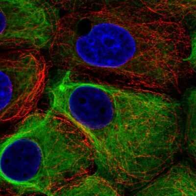 Immunocytochemistry/ Immunofluorescence: Cytokeratin 19 Antibody [NBP1-85601]