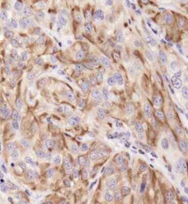 Immunohistochemistry: Cytokeratin 19 Antibody - BSA Free [NB100-687]