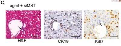 Immunohistochemistry: Cytokeratin 19 Antibody - BSA Free [NB100-687]