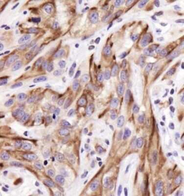 Immunohistochemistry: Cytokeratin 19 Antibody - BSA Free [NBP1-78278]