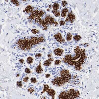 Immunohistochemistry-Paraffin: Cytokeratin 19 Antibody [NBP1-85601]