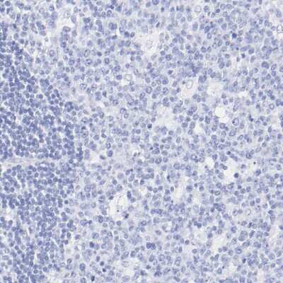 Immunohistochemistry-Paraffin: Cytokeratin 19 Antibody [NBP1-85601]