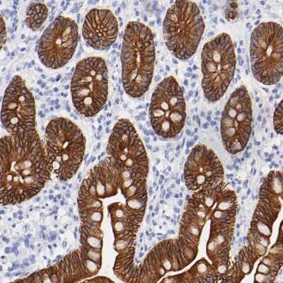 Immunohistochemistry-Paraffin: Cytokeratin 19 Antibody [NBP1-85601]