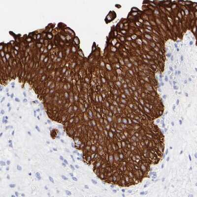 Immunohistochemistry-Paraffin: Cytokeratin 19 Antibody [NBP1-85601]