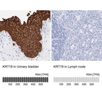 Immunohistochemistry-Paraffin: Cytokeratin 19 Antibody [NBP1-85601]