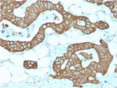 Immunohistochemistry-Paraffin: Cytokeratin 19 Antibody (KRT19/1959R) - Azide and BSA Free [NBP3-08635]