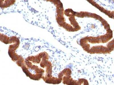 Immunohistochemistry-Paraffin: Cytokeratin 19 Antibody (KRT19/799 + KRT19/800) - Azide and BSA Free [NBP2-47948]