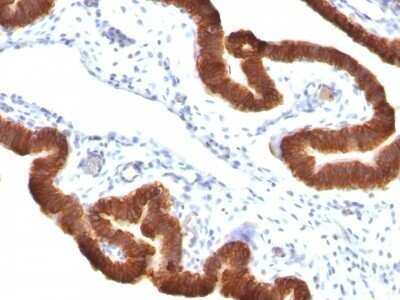 Immunohistochemistry-Paraffin: Cytokeratin 19 Antibody (KRT19/799 + KRT19/800) - IHC-Prediluted [NBP2-48101]
