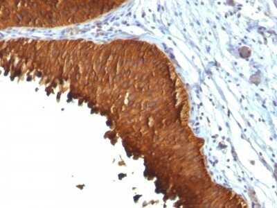 Immunohistochemistry-Paraffin: Cytokeratin 19 Antibody (KRT19/799 + KRT19/800) [NBP2-44829]