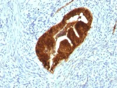 Immunohistochemistry-Paraffin: Cytokeratin 19 Antibody (KRT19/799 + KRT19/800) [NBP2-44829]