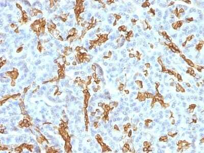 Immunohistochemistry-Paraffin: Cytokeratin 19 Antibody (KRT19/799 + KRT19/800) [NBP2-44829]