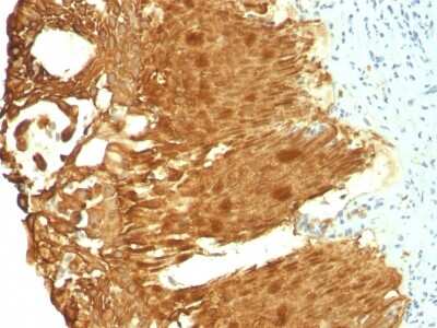 Immunohistochemistry-Paraffin: Cytokeratin 19 Antibody (KRT19/799 + KRT19/800) [NBP2-44829]