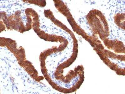 Immunohistochemistry-Paraffin: Cytokeratin 19 Antibody (KRT19/799) - Azide and BSA Free [NBP2-47945]