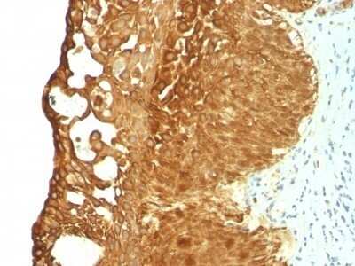 Immunohistochemistry-Paraffin: Cytokeratin 19 Antibody (KRT19/799) - IHC-Prediluted [NBP2-48086]