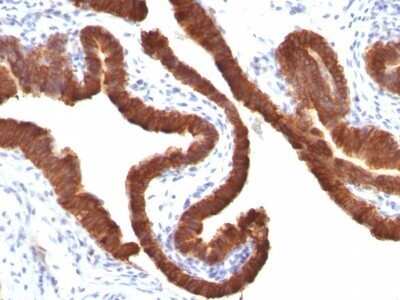 Immunohistochemistry-Paraffin: Cytokeratin 19 Antibody (KRT19/799) - IHC-Prediluted [NBP2-48086]